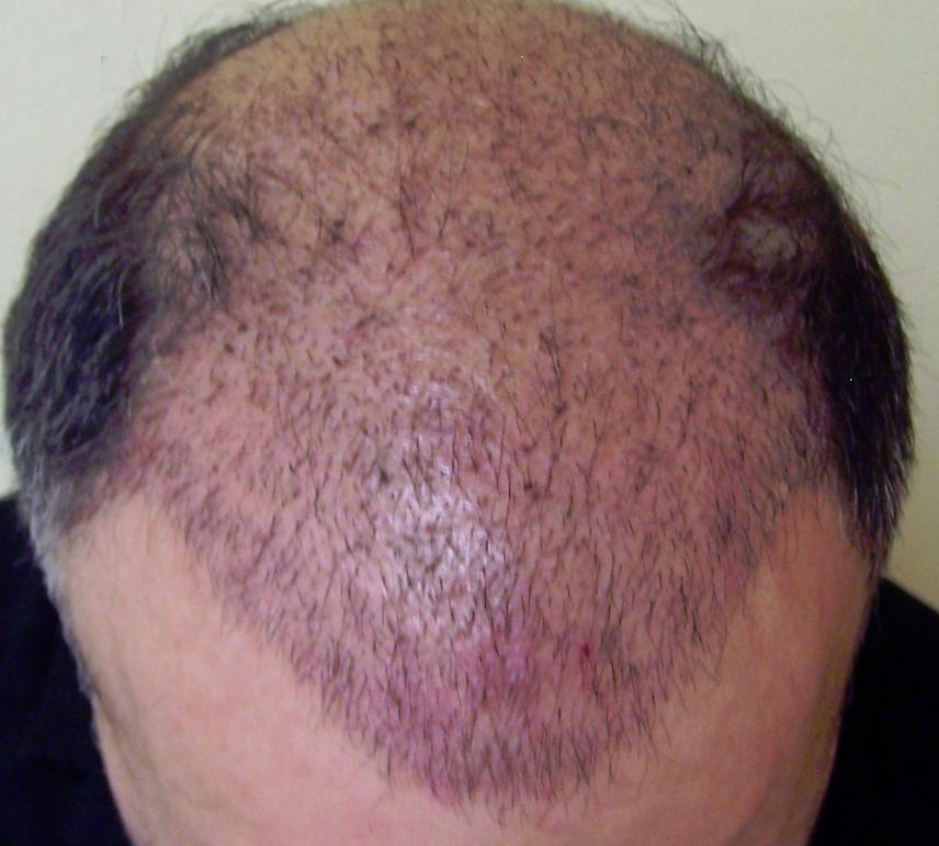 How To Restore Your Hair