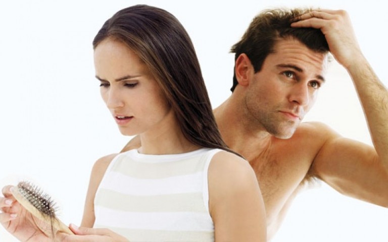 4 Common Types of Hair Loss