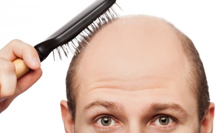 3 Ways To Treat Hair Loss
