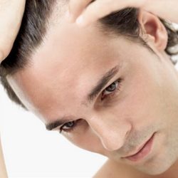 Male hair loss