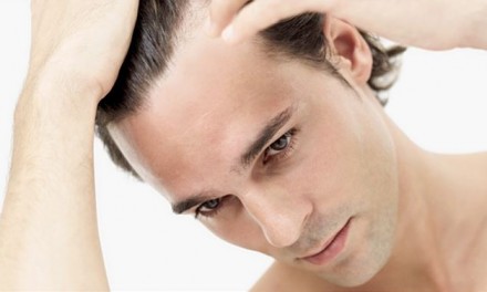 Are You At Risk For Hair Loss?