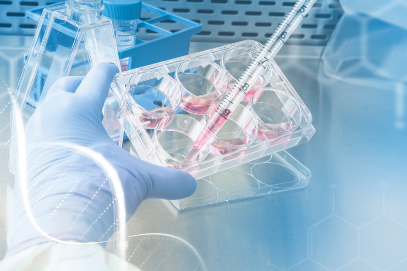 Exosome Hair Therapy