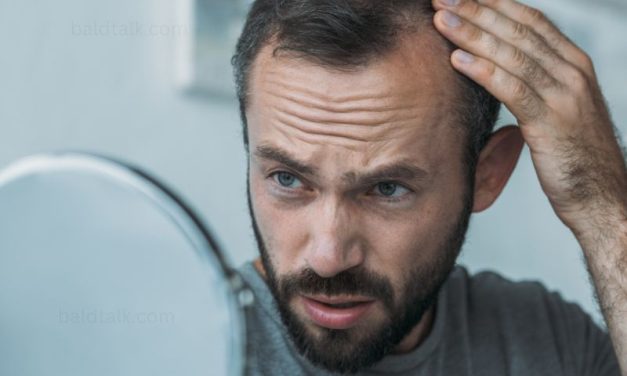 An Introduction to Understanding Hair Loss