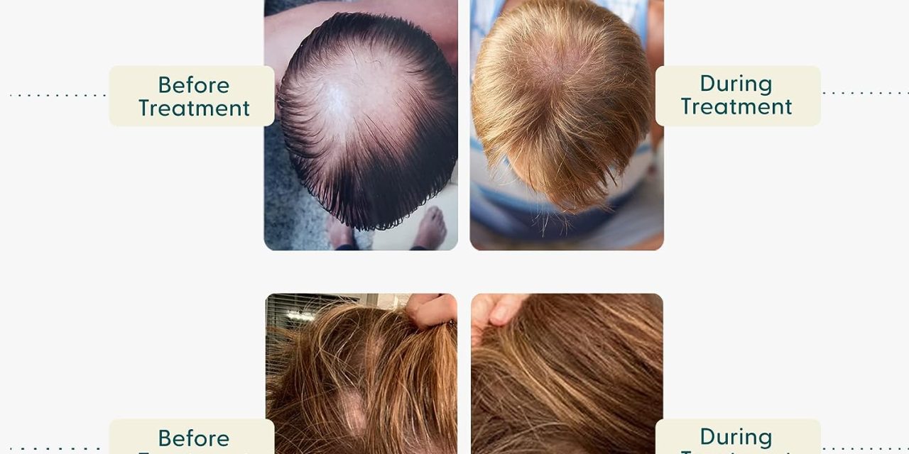 Shapiro MD Hair Loss Shampoo Review