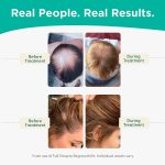 shapiro-md-hair-loss-shampoo-review