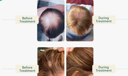 Shapiro MD Hair Loss Shampoo Review
