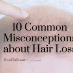 baldtalk 10 Common Misconceptions about Hair Loss